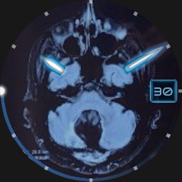 My Brain