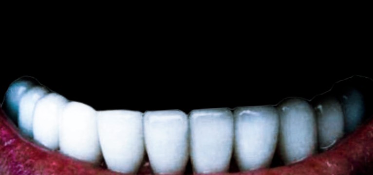 Teeth 2/2