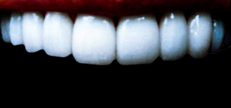Teeth 1/2